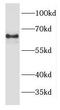 Epoxide Hydrolase 2 antibody, FNab02811, FineTest, Western Blot image 