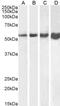 Desmin antibody, GTX88510, GeneTex, Western Blot image 