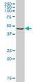 Ring Finger Protein 1 antibody, LS-C139296, Lifespan Biosciences, Western Blot image 