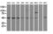 LEM Domain Containing 3 antibody, GTX84222, GeneTex, Western Blot image 