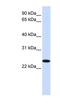 Zinc Finger DHHC-Type Containing 19 antibody, NBP1-60100, Novus Biologicals, Western Blot image 