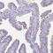 Chromosome 2 Open Reading Frame 50 antibody, NBP2-32374, Novus Biologicals, Immunohistochemistry frozen image 