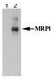ATP Binding Cassette Subfamily C Member 1 antibody, TA309560, Origene, Western Blot image 