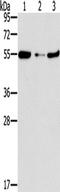 FGFR1 Oncogene Partner antibody, TA349979, Origene, Western Blot image 