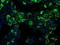 Aldehyde Dehydrogenase 2 Family Member antibody, NBP2-02102, Novus Biologicals, Immunofluorescence image 