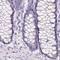 BPI Fold Containing Family B Member 2 antibody, NBP2-38887, Novus Biologicals, Immunohistochemistry paraffin image 