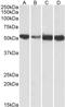 ATP Synthase F1 Subunit Alpha antibody, TA327766, Origene, Western Blot image 