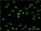 ISL LIM Homeobox 1 antibody, H00003670-M03, Novus Biologicals, Immunocytochemistry image 