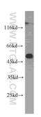 Aldehyde Dehydrogenase 1 Family Member A1 antibody, 60171-1-Ig, Proteintech Group, Western Blot image 