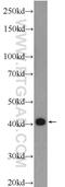 Tropomyosin 3 antibody, 55444-1-AP, Proteintech Group, Western Blot image 