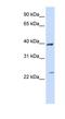 Acyl-CoA Dehydrogenase Long Chain antibody, NBP1-54763, Novus Biologicals, Western Blot image 