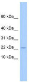 Golgin A7 Family Member B antibody, TA334931, Origene, Western Blot image 