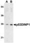 Tumor Protein P53 Inducible Nuclear Protein 1 antibody, MBS151022, MyBioSource, Western Blot image 