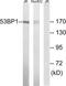 p53BP1 antibody, TA312841, Origene, Western Blot image 