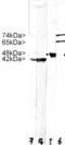 Lamin A/C antibody, LS-C204530, Lifespan Biosciences, Western Blot image 