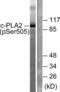 Phospholipase A2 Group IVA antibody, LS-C198828, Lifespan Biosciences, Western Blot image 
