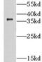 Citrate Lyase Beta Like antibody, FNab01783, FineTest, Western Blot image 