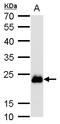 RAB6A, Member RAS Oncogene Family antibody, TA307958, Origene, Western Blot image 