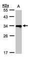 HLA class II histocompatibility antigen, DRB1-11 beta chain antibody, LS-C185457, Lifespan Biosciences, Western Blot image 