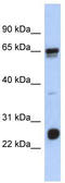 Uncharacterized protein C1orf103 antibody, TA336159, Origene, Western Blot image 