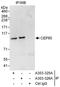Centrosomal Protein 85 antibody, A303-325A, Bethyl Labs, Immunoprecipitation image 