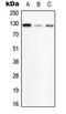 Phosphorylase Kinase Regulatory Subunit Beta antibody, MBS821569, MyBioSource, Western Blot image 