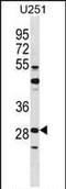 FOS Like 2, AP-1 Transcription Factor Subunit antibody, PA5-35174, Invitrogen Antibodies, Western Blot image 