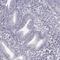 Chromosome 16 Open Reading Frame 86 antibody, PA5-67294, Invitrogen Antibodies, Immunohistochemistry paraffin image 