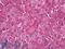 Stromelysin-3 antibody, LS-B7960, Lifespan Biosciences, Immunohistochemistry paraffin image 