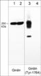 Coiled-Coil Domain Containing 88A antibody, GP5801, ECM Biosciences, Western Blot image 