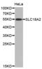Solute Carrier Family 18 Member A2 antibody, abx002099, Abbexa, Western Blot image 