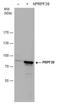 Pre-MRNA Processing Factor 39 antibody, GTX104949, GeneTex, Western Blot image 