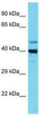 Solute Carrier Family 35 Member E1 antibody, TA330757, Origene, Western Blot image 