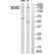 SOS Ras/Rho Guanine Nucleotide Exchange Factor 2 antibody, A05957, Boster Biological Technology, Western Blot image 