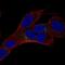 Neuronal Vesicle Trafficking Associated 2 antibody, NBP2-68670, Novus Biologicals, Immunofluorescence image 