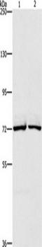 Carboxyl Ester Lipase antibody, TA351006, Origene, Western Blot image 