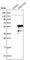 Family With Sequence Similarity 170 Member A antibody, NBP2-32706, Novus Biologicals, Western Blot image 