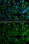 4-Hydroxyphenylpyruvate Dioxygenase antibody, GTX33247, GeneTex, Immunofluorescence image 
