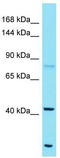 Family With Sequence Similarity 184 Member A antibody, TA335467, Origene, Western Blot image 