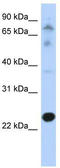Cysteine Rich Hydrophobic Domain 2 antibody, TA341897, Origene, Western Blot image 