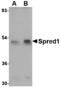 Sprouty Related EVH1 Domain Containing 1 antibody, A03613, Boster Biological Technology, Western Blot image 