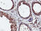 Dual Specificity Phosphatase 23 antibody, TA503944, Origene, Immunohistochemistry paraffin image 