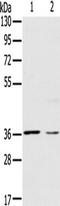Ceramide Synthase 1 antibody, TA351341, Origene, Western Blot image 