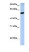 HLA class I histocompatibility antigen, alpha chain F antibody, NBP1-59537, Novus Biologicals, Western Blot image 
