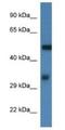 Fascin Actin-Bundling Protein 1 antibody, NBP1-74212, Novus Biologicals, Western Blot image 