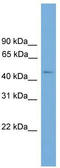 Chromosome 11 Open Reading Frame 16 antibody, TA344774, Origene, Western Blot image 