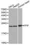 Peptidylprolyl Isomerase F antibody, orb136690, Biorbyt, Western Blot image 