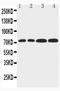 F-box/LRR-repeat protein 4 antibody, PA2192, Boster Biological Technology, Western Blot image 