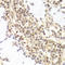 Polyhomeotic-like protein 1 antibody, LS-C335607, Lifespan Biosciences, Immunohistochemistry paraffin image 