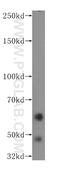 NUMB Endocytic Adaptor Protein antibody, 60137-1-Ig, Proteintech Group, Western Blot image 